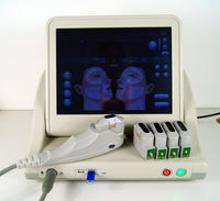 HIFU (High Intensity Focused Ultrasound)