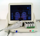 HIFU (High Intensity Focused Ultrasound)